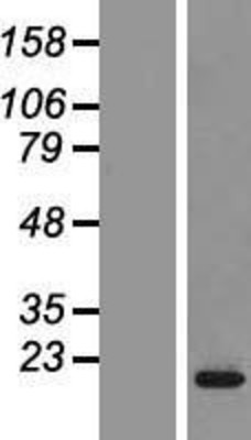Western Blot: CPLX2 Overexpression Lysate (Adult Normal) [NBP2-09835] Left-Empty vector transfected control cell lysate (HEK293 cell lysate); Right -Over-expression Lysate for CPLX2.