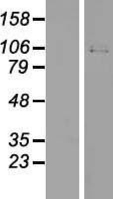 Western Blot: TRPV4 Overexpression Lysate (Adult Normal) [NBL1-17343] Left-Empty vector transfected control cell lysate (HEK293 cell lysate); Right -Over-expression Lysate for TRPV4.