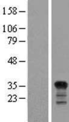 Western Blot: PIG3 Overexpression Lysate (Adult Normal) [NBP2-11589] Left-Empty vector transfected control cell lysate (HEK293 cell lysate); Right -Over-expression Lysate for PIG3.