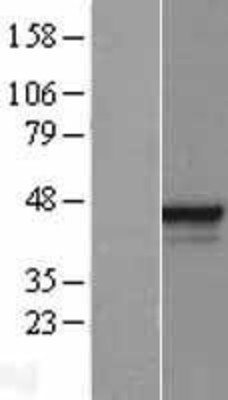 Western Blot: ESE1 Overexpression Lysate (Adult Normal) [NBP2-11404] Left-Empty vector transfected control cell lysate (HEK293 cell lysate); Right -Over-expression Lysate for ESE1.
