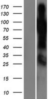 Western Blot: SHQ1 Overexpression Lysate (Adult Normal) [NBP2-06867] Left-Empty vector transfected control cell lysate (HEK293 cell lysate); Right -Over-expression Lysate for SHQ1.