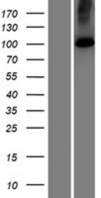 Western Blot: ATP2C2 Overexpression Lysate (Adult Normal) [NBP2-07263] Left-Empty vector transfected control cell lysate (HEK293 cell lysate); Right -Over-expression Lysate for ATP2C2.
