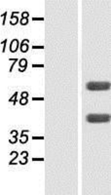 Western Blot: FLVCR2 Overexpression Lysate (Adult Normal) [NBP2-06917] Left-Empty vector transfected control cell lysate (HEK293 cell lysate); Right -Over-expression Lysate for FLVCR2.