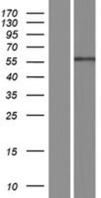 Western Blot: ENDOD1 Overexpression Lysate (Adult Normal) [NBP2-07224] Left-Empty vector transfected control cell lysate (HEK293 cell lysate); Right -Over-expression Lysate for ENDOD1.