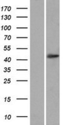 Western Blot: OTUD3 Overexpression Lysate (Adult Normal) [NBP2-07203] Left-Empty vector transfected control cell lysate (HEK293 cell lysate); Right -Over-expression Lysate for OTUD3.