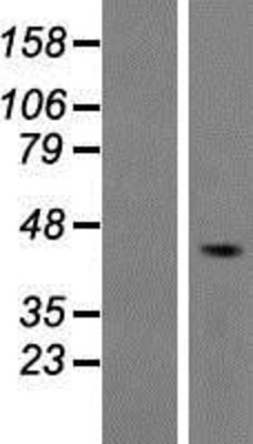 Western Blot: 5HT4 Receptor Overexpression Lysate (Adult Normal) [NBP2-04614] Left-Empty vector transfected control cell lysate (HEK293 cell lysate); Right -Over-expression Lysate for 5HT4 Receptor.