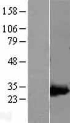 Western Blot: AK3L1 Overexpression Lysate (Adult Normal) [NBP2-04550] Left-Empty vector transfected control cell lysate (HEK293 cell lysate); Right -Over-expression Lysate for AK3L1.