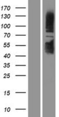 Western Blot: SIRT1 Overexpression Lysate (Adult Normal) [NBP2-04329] Left-Empty vector transfected control cell lysate (HEK293 cell lysate); Right -Over-expression Lysate for SIRT1.