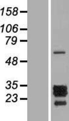Western Blot: PTHLH Overexpression Lysate (Adult Normal) [NBP2-04638] Left-Empty vector transfected control cell lysate (HEK293 cell lysate); Right -Over-expression Lysate for PTHLH.