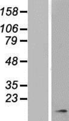 Western Blot: Histatin 3 Overexpression Lysate (Adult Normal) [NBP2-11154] Left-Empty vector transfected control cell lysate (HEK293 cell lysate); Right -Over-expression Lysate for Histatin 3.