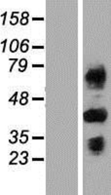 Western Blot: C4 binding protein B Overexpression Lysate (Adult Normal) [NBP2-11242] Left-Empty vector transfected control cell lysate (HEK293 cell lysate); Right -Over-expression Lysate for C4 binding protein B.