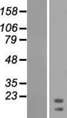Western Blot: RPL21 Overexpression Lysate (Adult Normal) [NBP2-04463] Left-Empty vector transfected control cell lysate (HEK293 cell lysate); Right -Over-expression Lysate for RPL21.