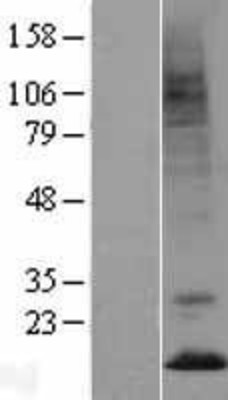 Western Blot: Prokineticin 2 Overexpression Lysate (Adult Normal) [NBL1-14807] Left-Empty vector transfected control cell lysate (HEK293 cell lysate); Right -Over-expression Lysate for Prokineticin 2.