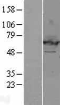 Western Blot: EHD2 Overexpression Lysate (Adult Normal) [NBL1-10158] Left-Empty vector transfected control cell lysate (HEK293 cell lysate); Right -Over-expression Lysate for EHD2.