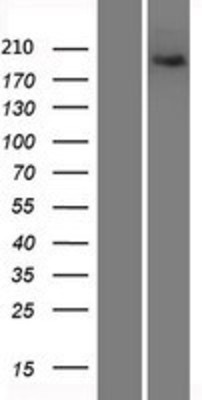 Western Blot: Xrn1 Overexpression Lysate (Adult Normal) [NBP2-06746] Left-Empty vector transfected control cell lysate (HEK293 cell lysate); Right -Over-expression Lysate for Xrn1.