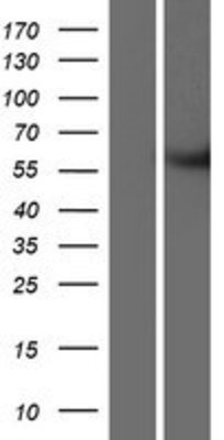 Western Blot: METTL2B Overexpression Lysate (Adult Normal) [NBP2-06799] Left-Empty vector transfected control cell lysate (HEK293 cell lysate); Right -Over-expression Lysate for METTL2B.