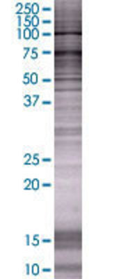 ITGB2 transfected lysate.