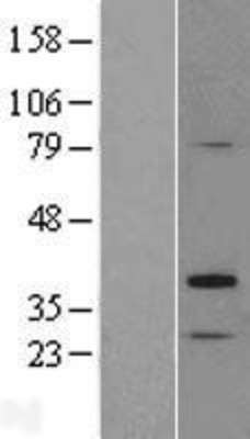 Western Blot: TP53TG5 Overexpression Lysate (Adult Normal) [NBL1-08353] Left-Empty vector transfected control cell lysate (HEK293 cell lysate); Right -Over-expression Lysate for TP53TG5.