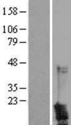 Western Blot: CD90/Thy1 Overexpression Lysate (Adult Normal) [NBL1-16904] Left-Empty vector transfected control cell lysate (HEK293 cell lysate); Right -Over-expression Lysate for CD90/Thy1.