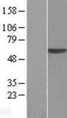 Western Blot: USP22 Overexpression Lysate (Adult Normal) [NBL1-17653] Left-Empty vector transfected control cell lysate (HEK293 cell lysate); Right -Over-expression Lysate for USP22.