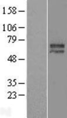 Western Blot: HDAC2 Overexpression Lysate (Adult Normal) [NBL1-11480] Left-Empty vector transfected control cell lysate (HEK293 cell lysate); Right -Over-expression Lysate for HDAC2.