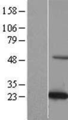 Western Blot: C19orf50 Overexpression Lysate (Adult Normal) [NBL1-08275] Left-Empty vector transfected control cell lysate (HEK293 cell lysate); Right -Over-expression Lysate for C19orf50.