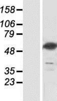 Western Blot: NT5DC3 Overexpression Lysate (Adult Normal) [NBP2-07014] Left-Empty vector transfected control cell lysate (HEK293 cell lysate); Right -Over-expression Lysate for NT5DC3.
