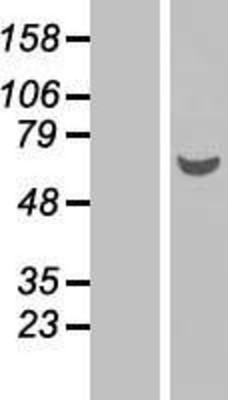Western Blot: GDAP2 Overexpression Lysate (Adult Normal) [NBP2-06937] Left-Empty vector transfected control cell lysate (HEK293 cell lysate); Right -Over-expression Lysate for GDAP2.