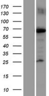 Western Blot: KIF22 Overexpression Lysate (Adult Normal) [NBP2-07509] Left-Empty vector transfected control cell lysate (HEK293 cell lysate); Right -Over-expression Lysate for KIF22.