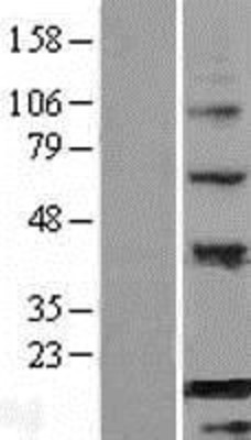 Western Blot: BATF Overexpression Lysate (Adult Normal) [NBP2-07623] Left-Empty vector transfected control cell lysate (HEK293 cell lysate); Right -Over-expression Lysate for BATF.