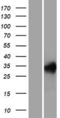 Western Blot: REM1 Overexpression Lysate (Adult Normal) [NBP2-07388] Left-Empty vector transfected control cell lysate (HEK293 cell lysate); Right -Over-expression Lysate for REM1.