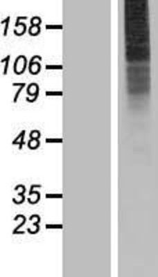 Western Blot: SLC35A3 Overexpression Lysate (Adult Normal) [NBP2-07471] Left-Empty vector transfected control cell lysate (HEK293 cell lysate); Right -Over-expression Lysate for SLC35A3.
