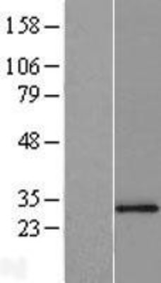 Western Blot: SLC25A15 Overexpression Lysate (Adult Normal) [NBP2-07366] Left-Empty vector transfected control cell lysate (HEK293 cell lysate); Right -Over-expression Lysate for SLC25A15.
