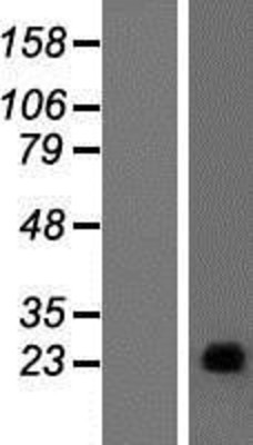 Western Blot: PAGE4 Overexpression Lysate (Adult Normal) [NBP2-07544] Left-Empty vector transfected control cell lysate (HEK293 cell lysate); Right -Over-expression Lysate for PAGE4.