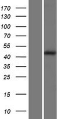 Western Blot: LAMP1 Overexpression Lysate (Adult Normal) [NBP2-07733] Left-Empty vector transfected control cell lysate (HEK293 cell lysate); Right -Over-expression Lysate for LAMP1.