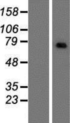 Western Blot: CNOT4 Overexpression Lysate (Adult Normal) [NBP2-07425] Left-Empty vector transfected control cell lysate (HEK293 cell lysate); Right -Over-expression Lysate for CNOT4.