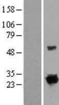Western Blot: RIT1 Overexpression Lysate (Adult Normal) [NBP2-07557] Left-Empty vector transfected control cell lysate (HEK293 cell lysate); Right -Over-expression Lysate for RIT1.