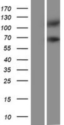 Western Blot: PSD4 Overexpression Lysate (Adult Normal) [NBP2-07441] Left-Empty vector transfected control cell lysate (HEK293 cell lysate); Right -Over-expression Lysate for PSD4.