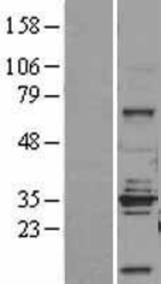 Western Blot: STEAP1 Overexpression Lysate (Adult Normal) [NBP2-04337] Left-Empty vector transfected control cell lysate (HEK293 cell lysate); Right -Over-expression Lysate for STEAP1.