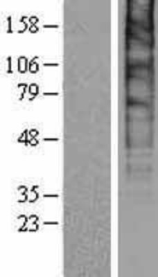 Western Blot: SLC48A1 Overexpression Lysate (Adult Normal) [NBP2-04365] Left-Empty vector transfected control cell lysate (HEK293 cell lysate); Right -Over-expression Lysate for SLC48A1.