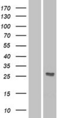 Western Blot: DKK2 Overexpression Lysate (Adult Normal) [NBP2-04343] Left-Empty vector transfected control cell lysate (HEK293 cell lysate); Right -Over-expression Lysate for DKK2.