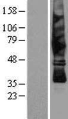 Western Blot: Somatostatin Receptor 4 Overexpression Lysate (Adult Normal) [NBP2-04191] Left-Empty vector transfected control cell lysate (HEK293 cell lysate); Right -Over-expression Lysate for Somatostatin Receptor 4.