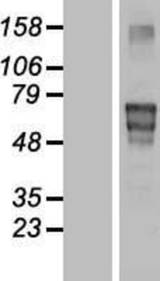 Western Blot: MATN4 Overexpression Lysate (Adult Normal) [NBP2-07945] Left-Empty vector transfected control cell lysate (HEK293 cell lysate); Right -Over-expression Lysate for MATN4.