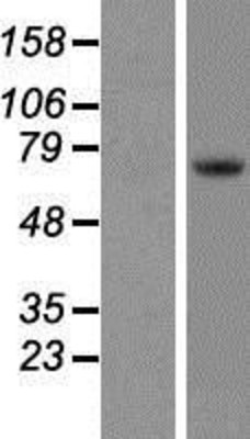 Western Blot: Tec Overexpression Lysate (Adult Normal) [NBP2-08029] Left-Empty vector transfected control cell lysate (HEK293 cell lysate); Right -Over-expression Lysate for Tec.