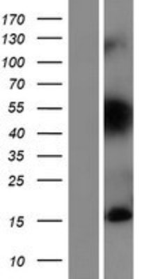 Western Blot: TIAF1 Overexpression Lysate (Adult Normal) [NBP2-07827] Left-Empty vector transfected control cell lysate (HEK293 cell lysate); Right -Over-expression Lysate for TIAF1.