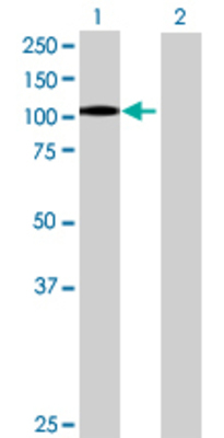 Lane 1: ITGB2 transfected lysate (84.7 KDa) Lane 2: Non-transfected lysate.
