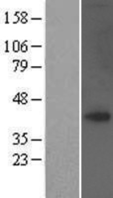 Western Blot: TRAM1 Overexpression Lysate (Adult Normal) [NBP2-07358] Left-Empty vector transfected control cell lysate (HEK293 cell lysate); Right -Over-expression Lysate for TRAM1.
