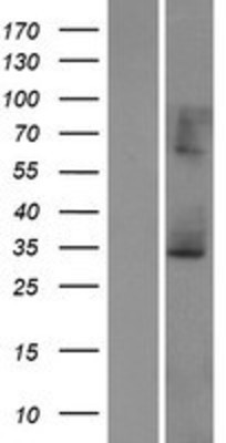 Western Blot: ECHS1 Overexpression Lysate (Adult Normal) [NBP2-07913] Left-Empty vector transfected control cell lysate (HEK293 cell lysate); Right -Over-expression Lysate for ECHS1.