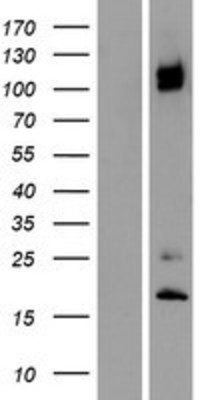 Western Blot: ITGA8 Overexpression Lysate (Adult Normal) [NBP2-07971] Left-Empty vector transfected control cell lysate (HEK293 cell lysate); Right -Over-expression Lysate for ITGA8.
