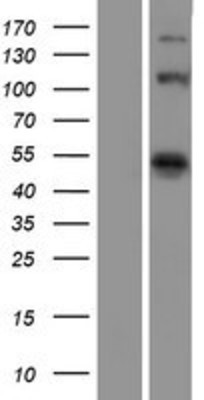 Western Blot: eIF4G1 Overexpression Lysate (Adult Normal) [NBP2-07806] Left-Empty vector transfected control cell lysate (HEK293 cell lysate); Right -Over-expression Lysate for eIF4G1.